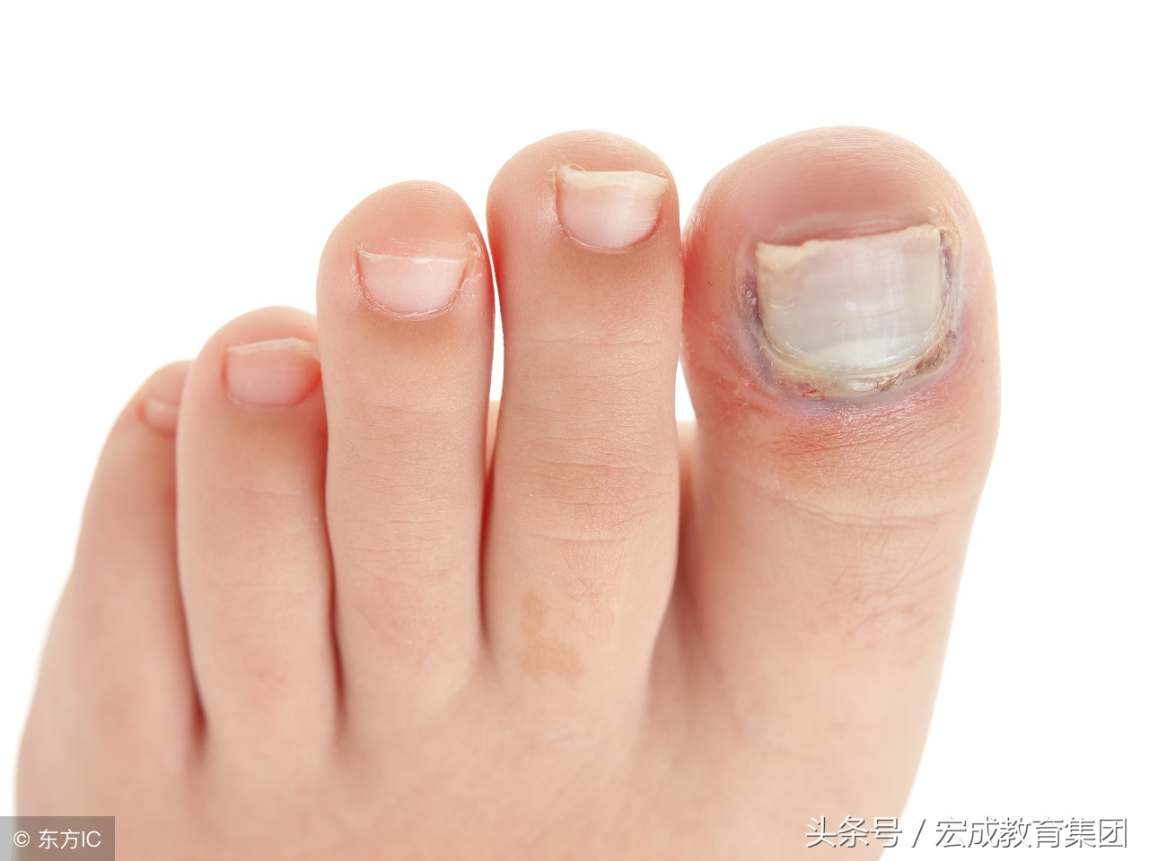 常见皮肤病用药及食疗方案,常见皮肤病诊断及用药图谱