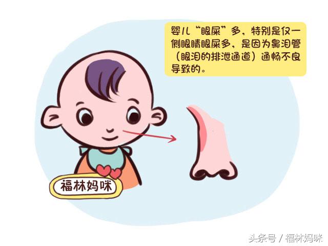 新生儿眼屎什么情况需要就医,新生儿眼屎多是什么原因造成的