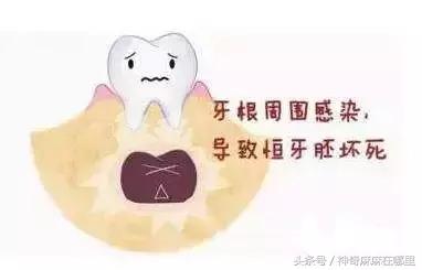 乳牙磕掉半颗怎么办,宝宝乳牙磕掉一小块怎样补救
