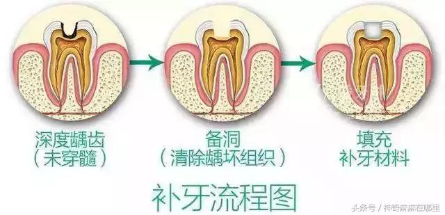 乳牙磕掉半颗怎么办,宝宝乳牙磕掉一小块怎样补救
