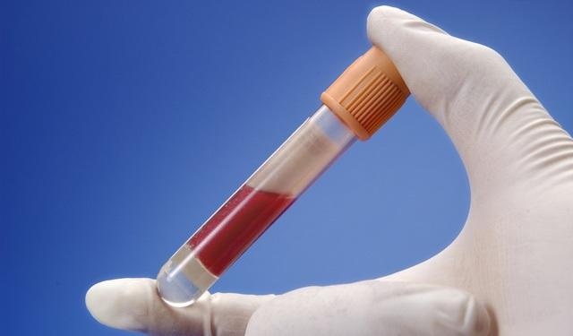 关于产后第42天检查的日记——从非专业者角度讲讲都检查些啥