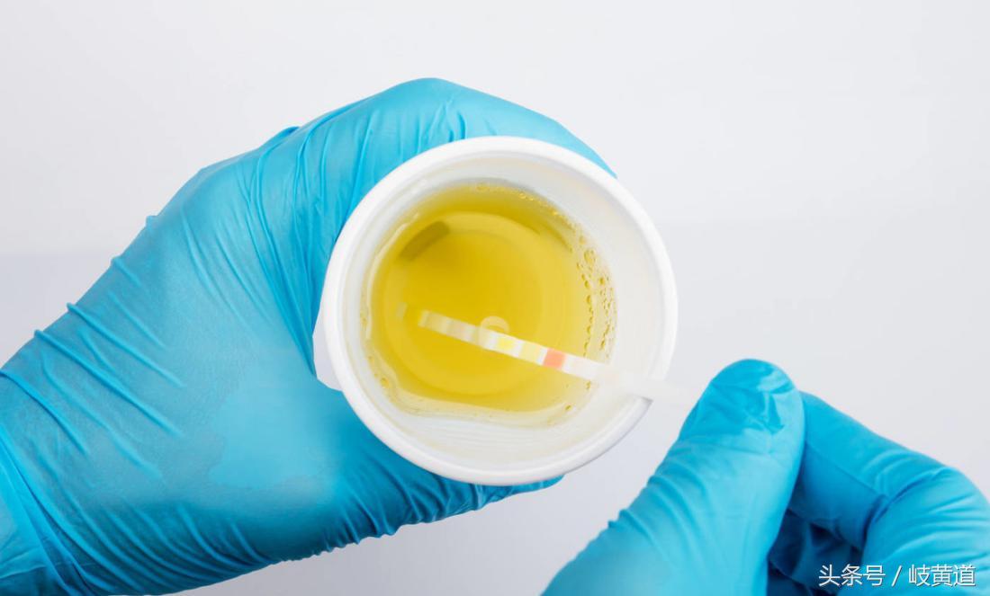 尿频尿急是尿路感染引起的吗,尿频尿急是不是尿路感染引起的