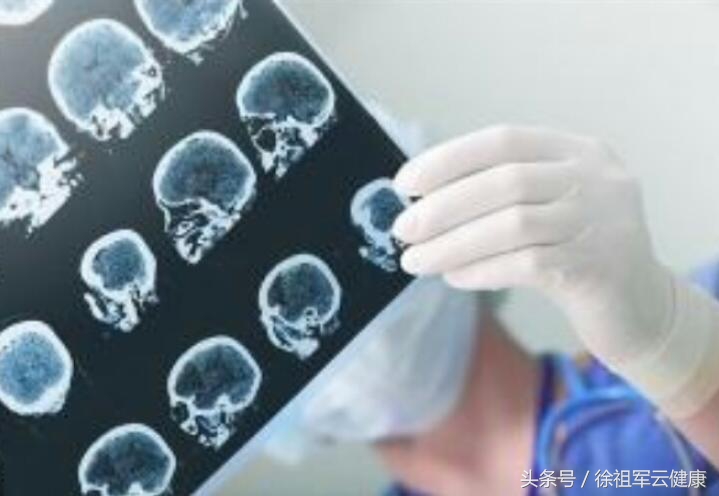 从2例脑血管疾病后遗症的康复，谈其综合理疗调理方案的实施