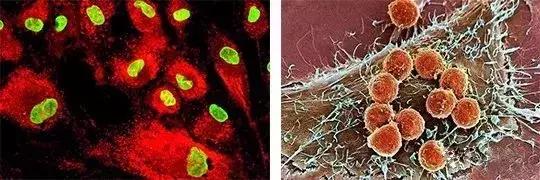 干细胞和免疫细胞同时回输,免疫细胞和干细胞相关知识