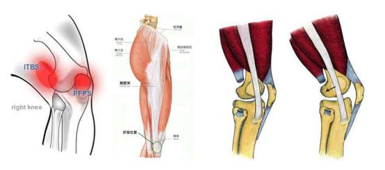 跑步膝盖痛理疗,跑步膝盖损伤贴点什么膏药