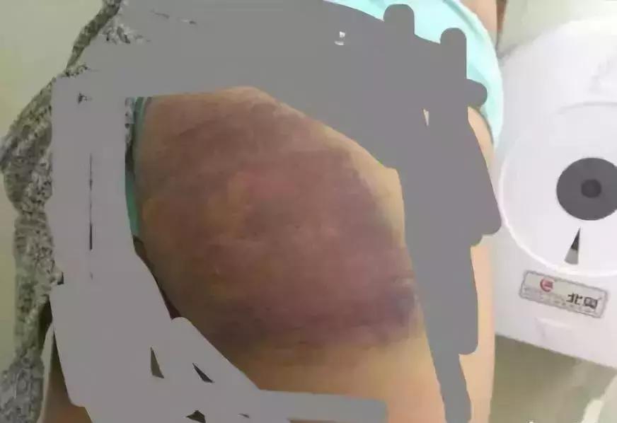 电击,针刺,鞭抽,虐童的临沂网戒所,传出一声声孩子惨叫