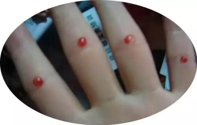 电击,针刺,鞭抽,虐童的临沂网戒所,传出一声声孩子惨叫