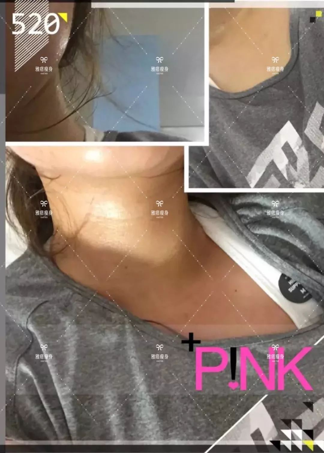 胖妞从180斤减到100斤,从180斤的小胖妞逆袭