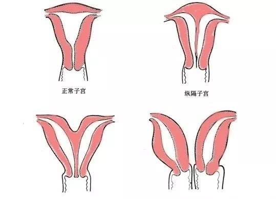 怀不了孩子的问题,怀不上孩子都是女人的问题吗