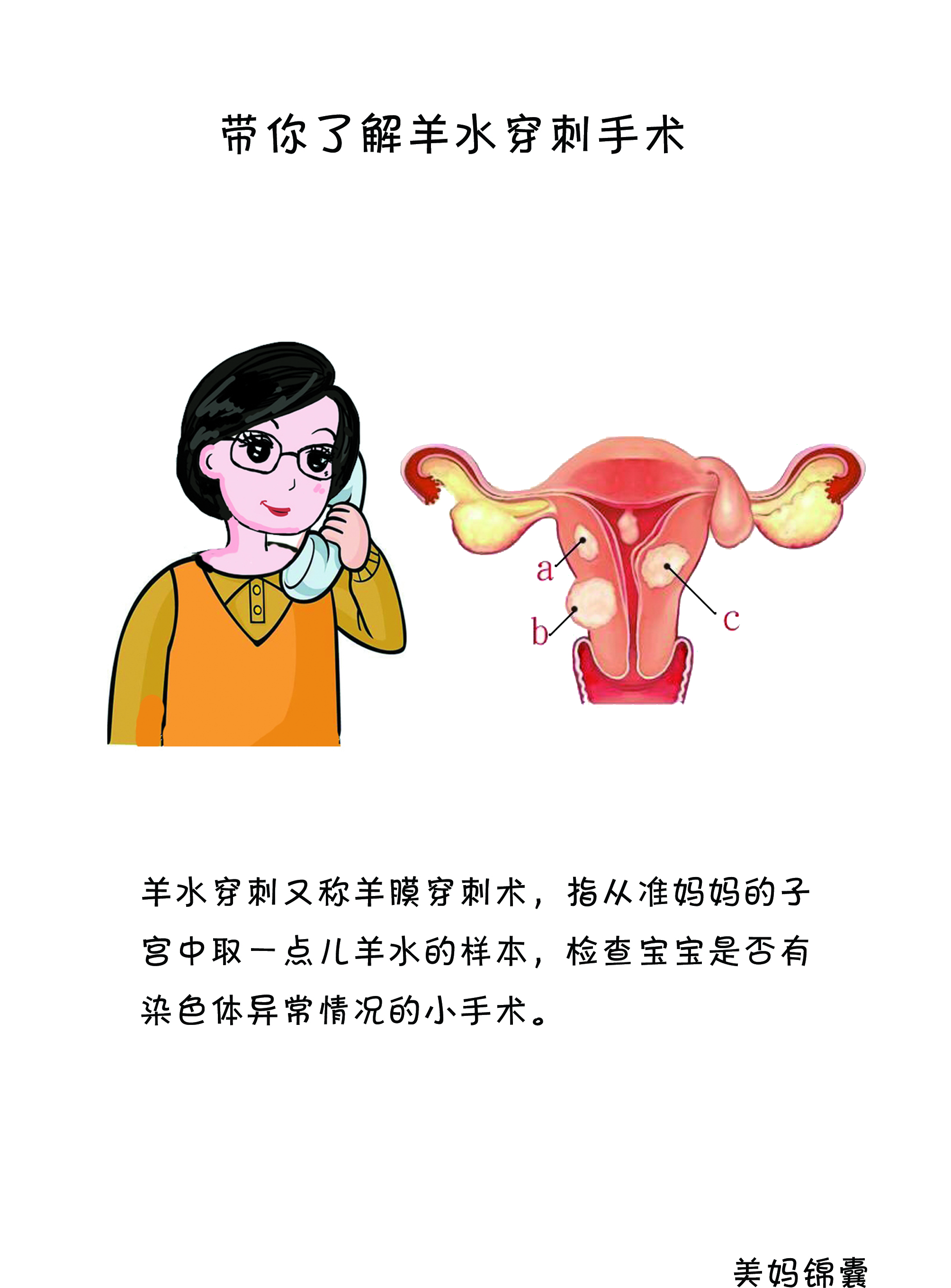 什么是羊水穿刺全过程,什么是羊水穿刺21三体