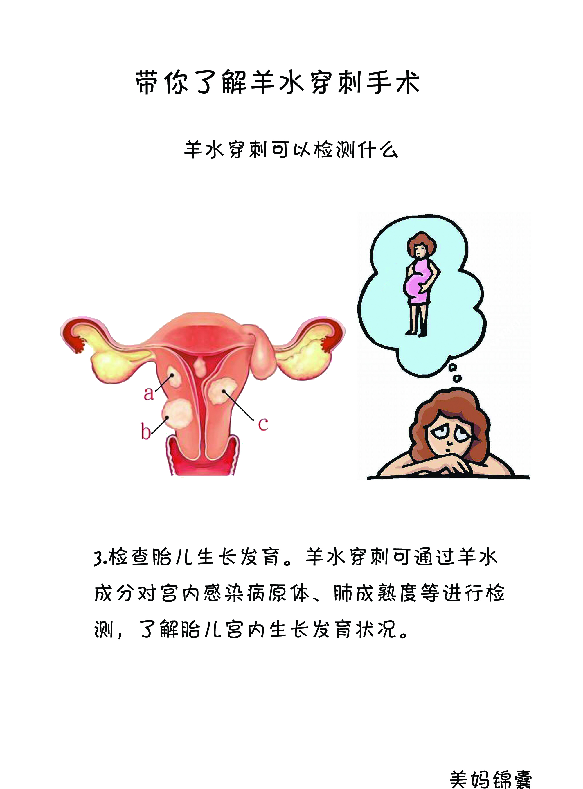 什么是羊水穿刺全过程,什么是羊水穿刺21三体