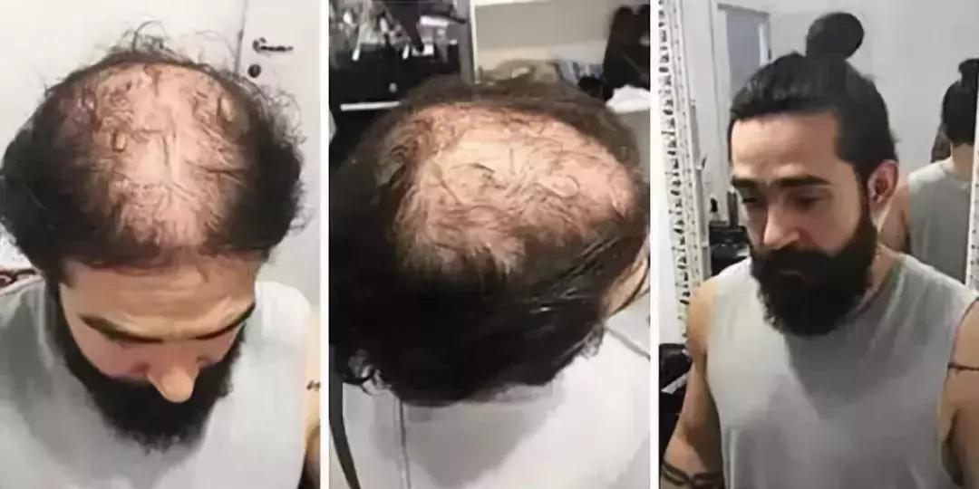 男生发型别在两边剃光了,男士发型莫得花里胡哨