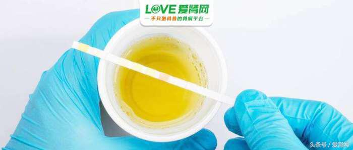 尿潜血一直有到底该不该治疗,尿潜血一直存在怎么回事