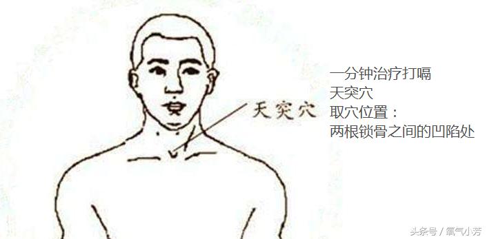 中医10个急救穴位图,10个急救穴