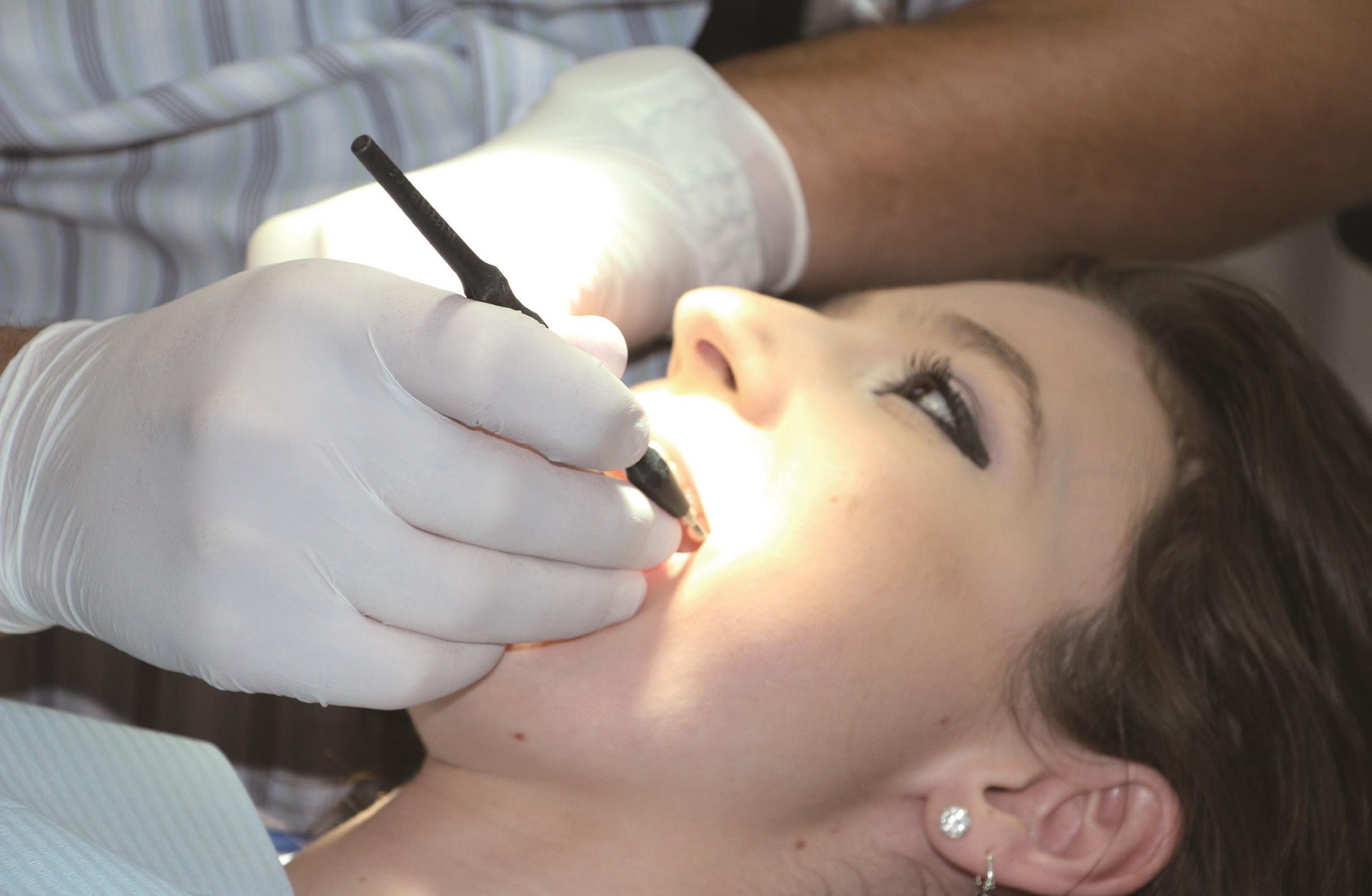 为什么洗牙的时候很痛,39.9洗牙和150洗牙有什么区别