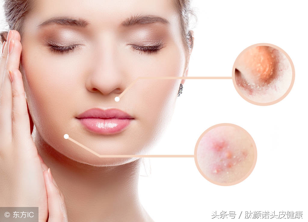 15岁女孩如何护肤,15岁女生夜间护肤