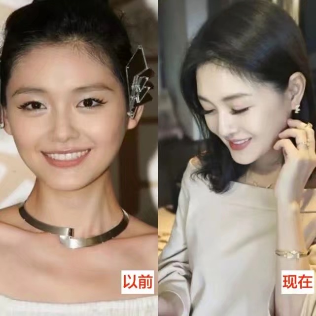 大s自曝美白最快的方法,大s美白抗凝血剂