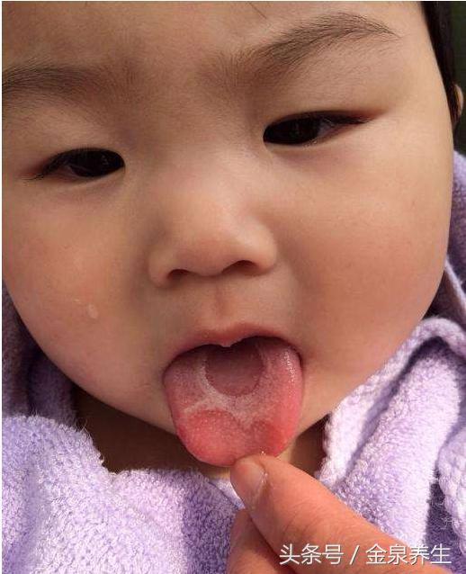 老中医看舌苔教程视频,一招教你看舌苔图片