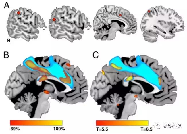 日报：季维智谈干细胞和基因编辑；红景天中活性成份或可增强记忆