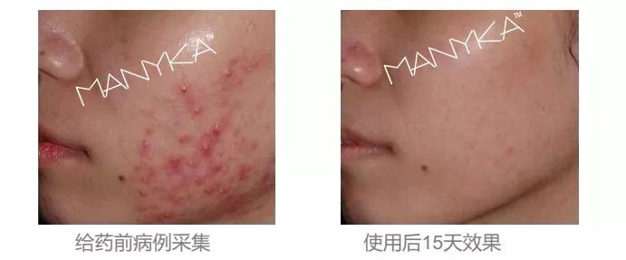 MANYKA（麦蜜卡）研发工程师专访：重新认识产品，从内而外