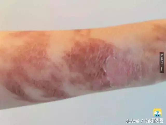 被雷劈是种什么样的体验?看完简直身受同感