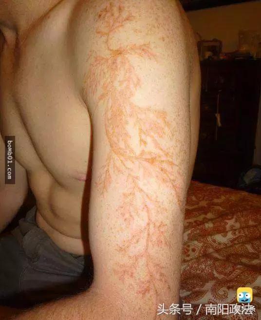 被雷劈是种什么样的体验?看完简直身受同感