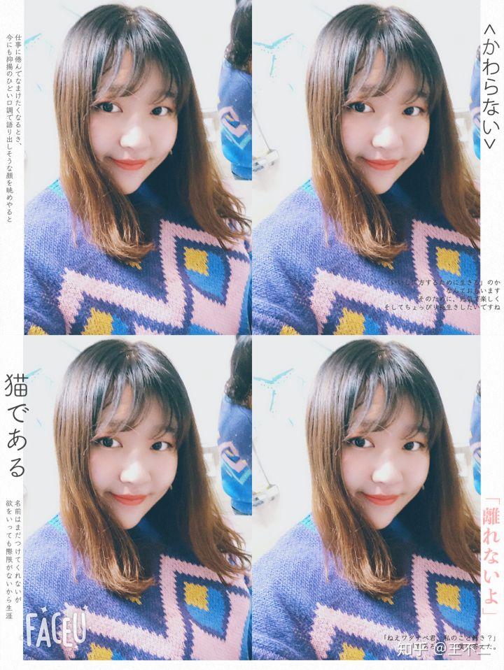 icl高度近视手术全过程,高度近视icl手术注意事项