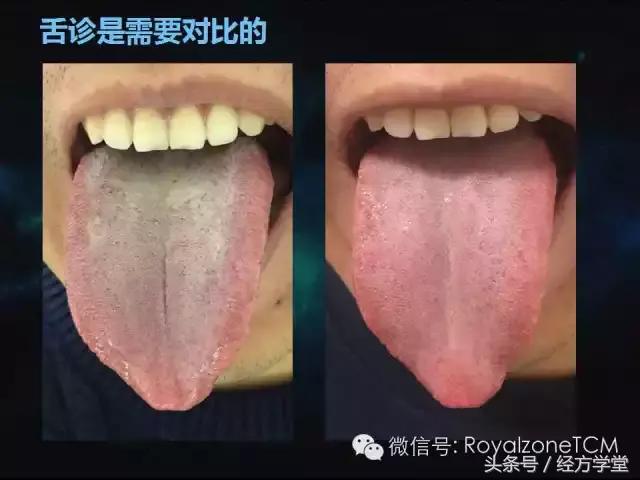 小熊医生,小熊医生舌诊