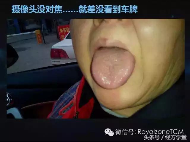 小熊医生,小熊医生舌诊