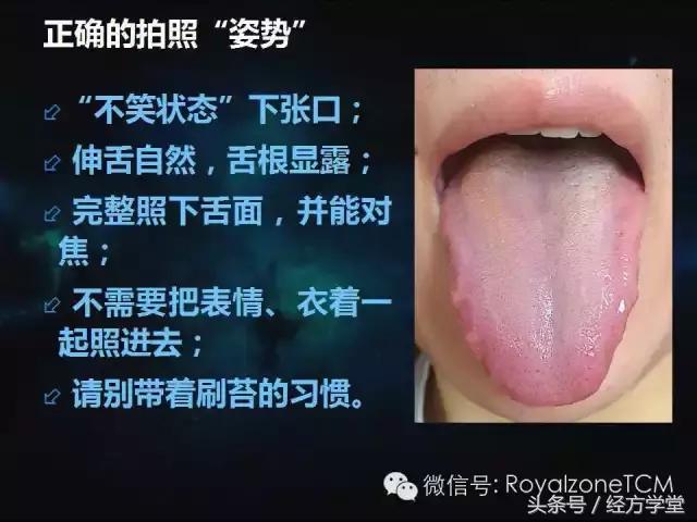 小熊医生,小熊医生舌诊