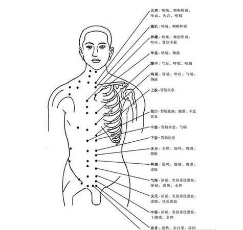 带状疱疹后遗症针灸治疗穴位,针灸火罐治疗带状疱疹