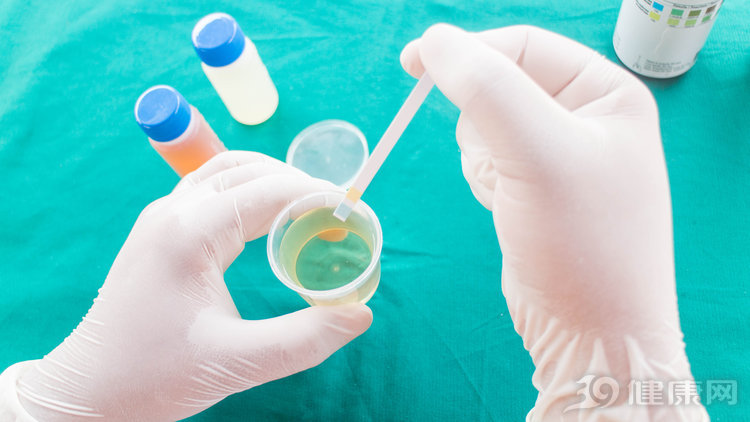 小便有泡沫一定是肾病吗,小便泡沫多是肾病的前兆吗