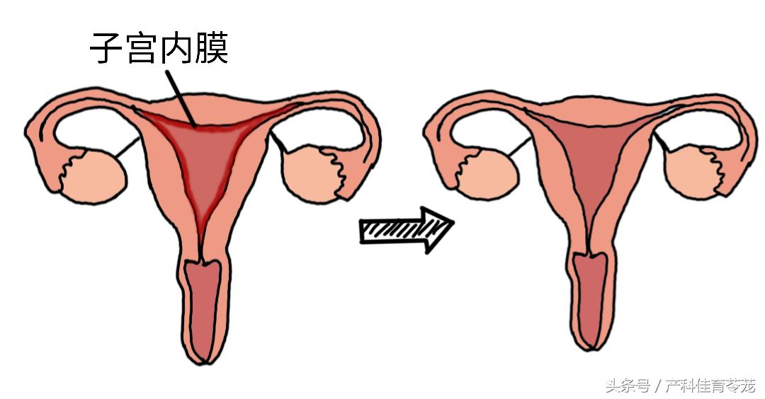 人流术后闭经，到底怎么了？