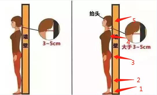 儿童驼背学什么改善,青少年驼背要怎么矫正