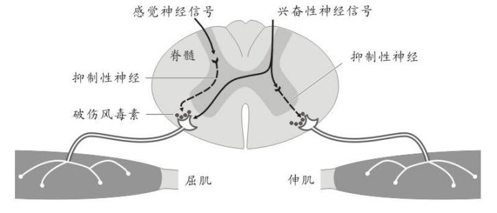 破伤风哪些伤口容易感染,什么样的伤口容易感染破伤风