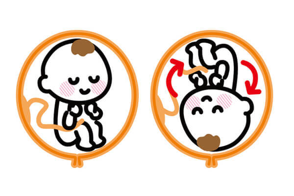 胎位不正的原因及纠正方法图,胎位不正的原因及纠正方法图片