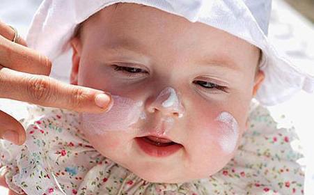 含激素湿疹膏副作用,不含有激素的湿疹膏有哪些