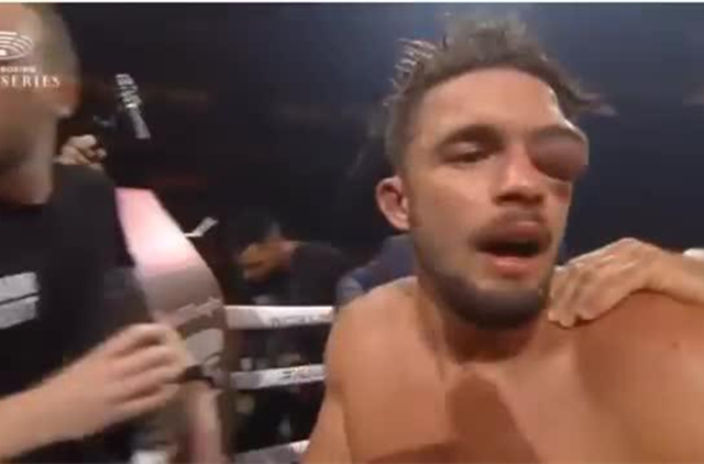 重量级拳击手重拳对普通人的伤害,拳击手的拳力为啥那么大