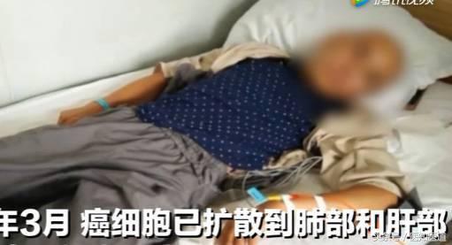 身上的痣会不会癌变一张图告诉你,身体上7种痣容易癌变