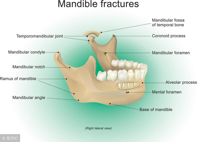 嘴巴张不开最快的方法,口腔癌嘴巴张不开