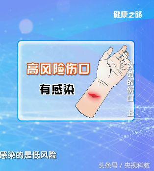 破伤风科普小知识,破伤风伤口最初症状