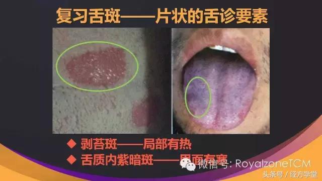 经方学堂一起学习舌诊,中医舌诊视频教程第一讲