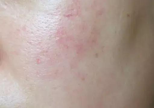 璧典附棰栧啹缁嶅嘲瀹樺绾㈣壊琛ｆ湇,璧典附棰栧珌缁欑埍鎯呯殑鏍峰瓙