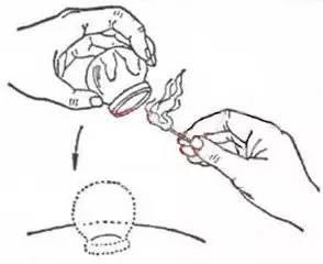 中医的拔罐有哪些作用,中医拔罐有什么作用与功效