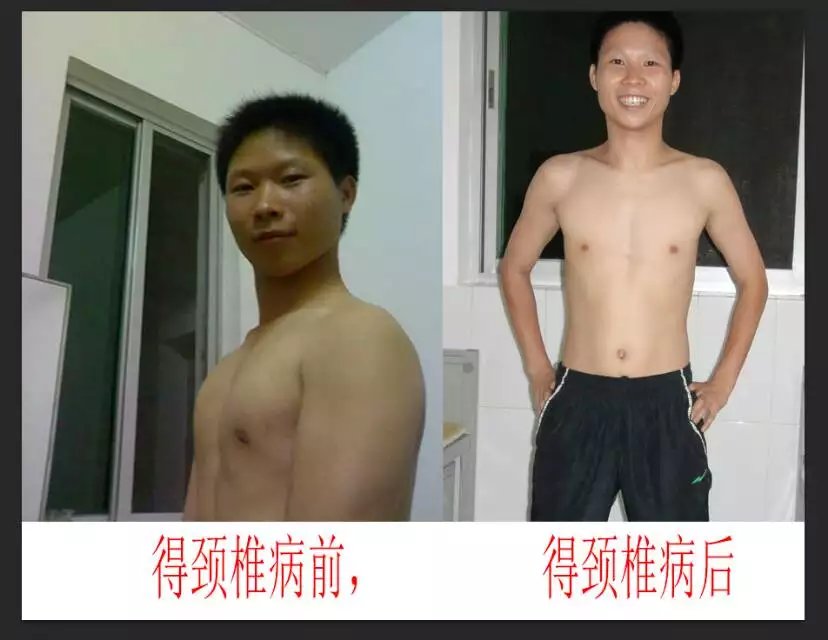怎样与颈椎病和平共处,和一个80后的成熟男人怎么相处