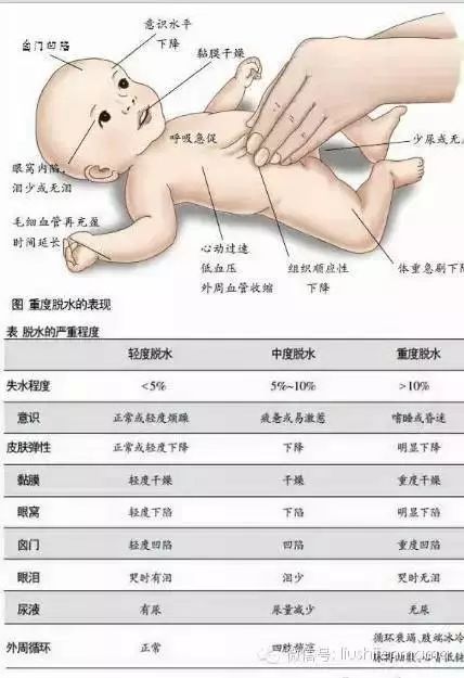 上吐下泻还发烧是什么原因导致的,上吐下泻还发烧是新型冠状病毒吗