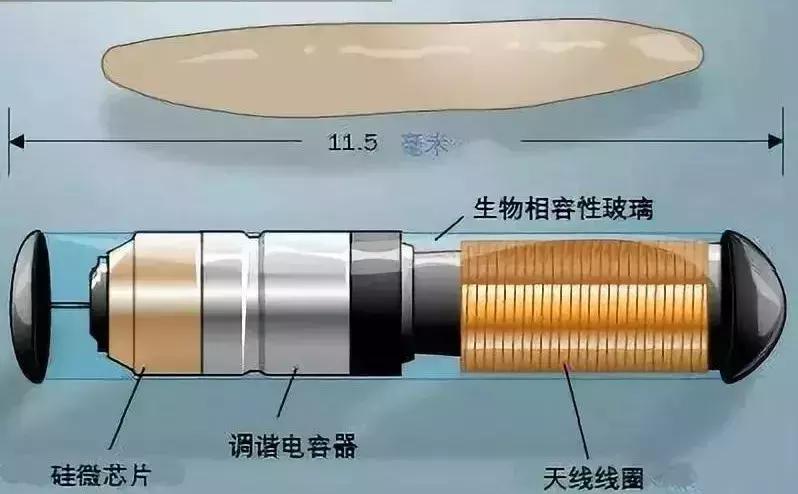 体内植入式芯片,人体芯片的真实现状有什么优势