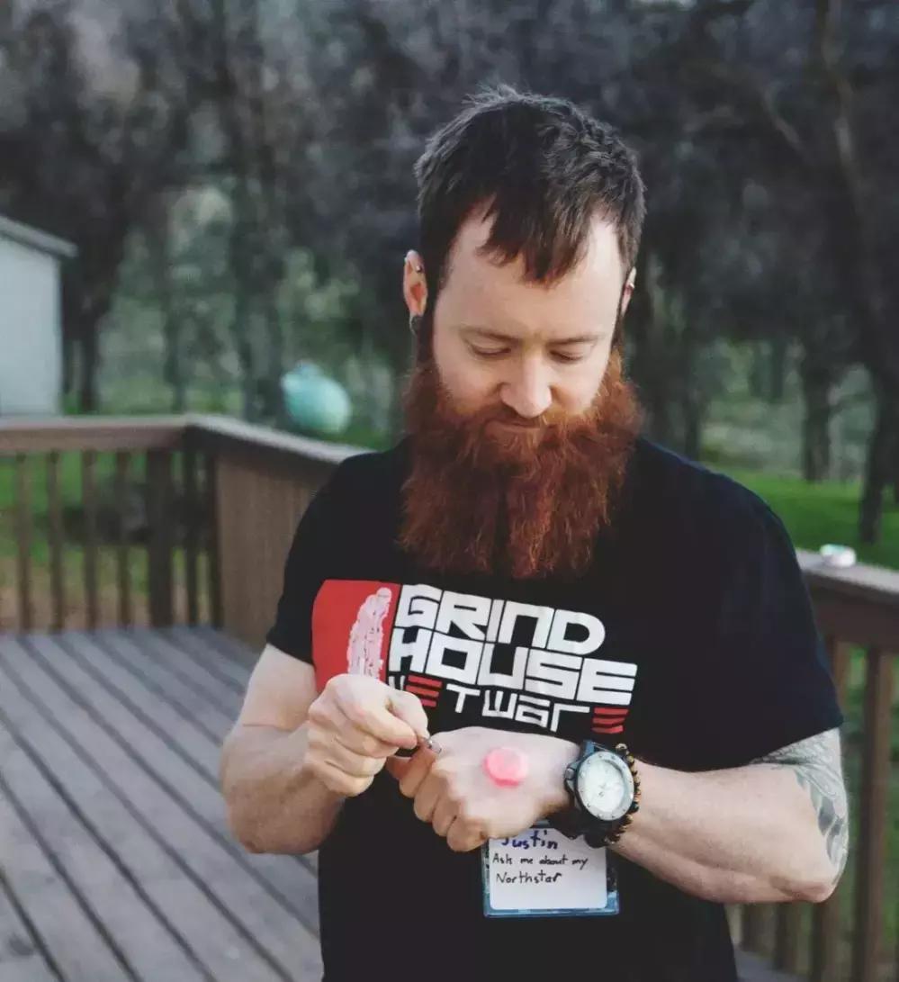 体内植入式芯片,人体芯片的真实现状有什么优势