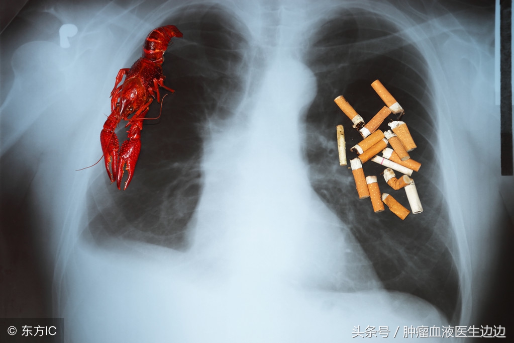 肿瘤医生最常问的问题,癌症重要的早期预警信号