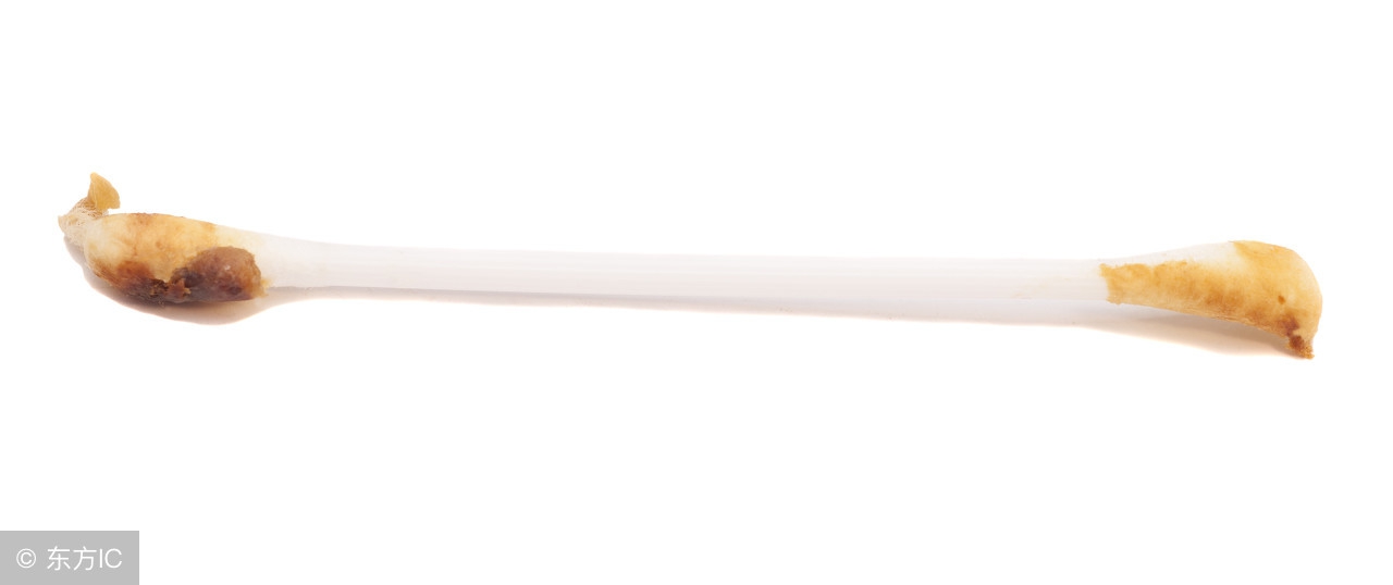 耳朵湿耳屎痒怎么处理,耳屎是湿黄色粘稠状怎么回事